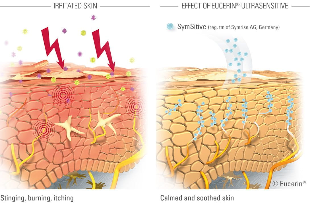 Hypersensitive Skin Image