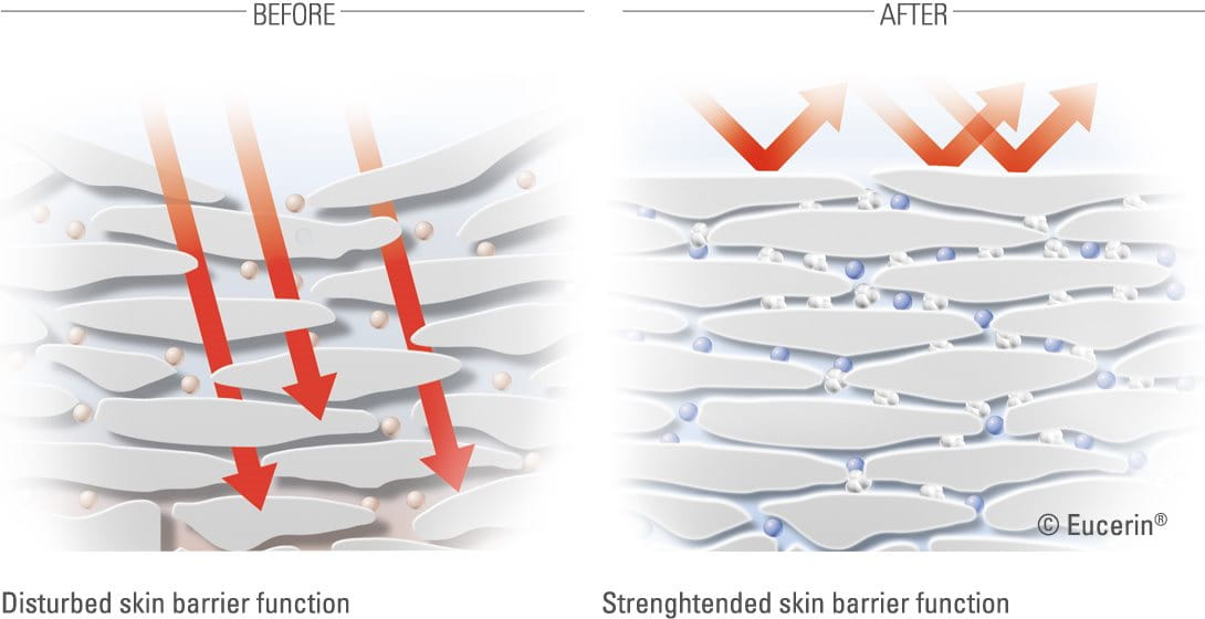 Disturbed skin barrier function, Strenghtended skin barrier function 