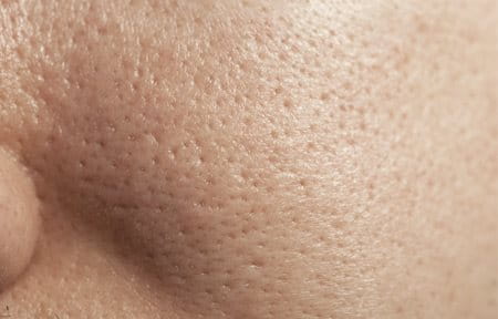 uvećani prikaz pora na masnoj koži