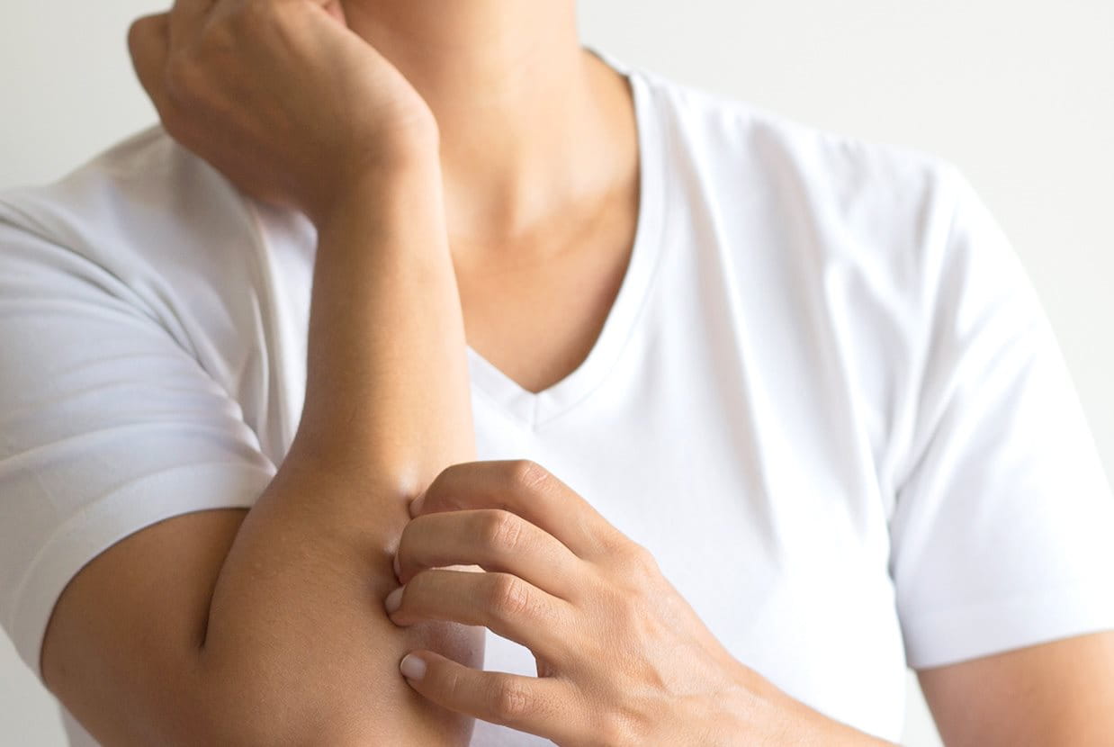 man scratching his elbow