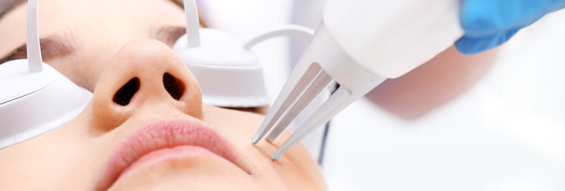 Laserbehandeling  wordt gebruikt voor een aantal verschillende huidproblemen