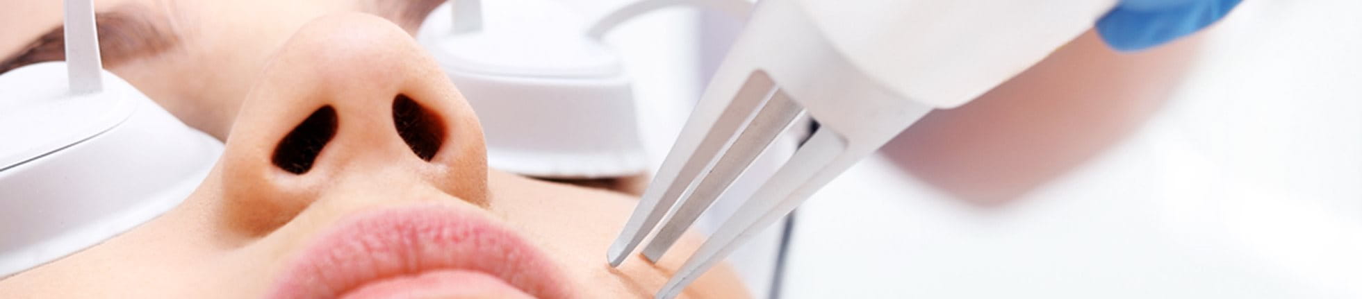 Laserbehandeling wordt gebruikt voor een aantal verschillende huidproblemen