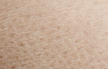 Ако имате изсушена кожа, тя не е в състояние да регулира нивото на своята хидратацията.