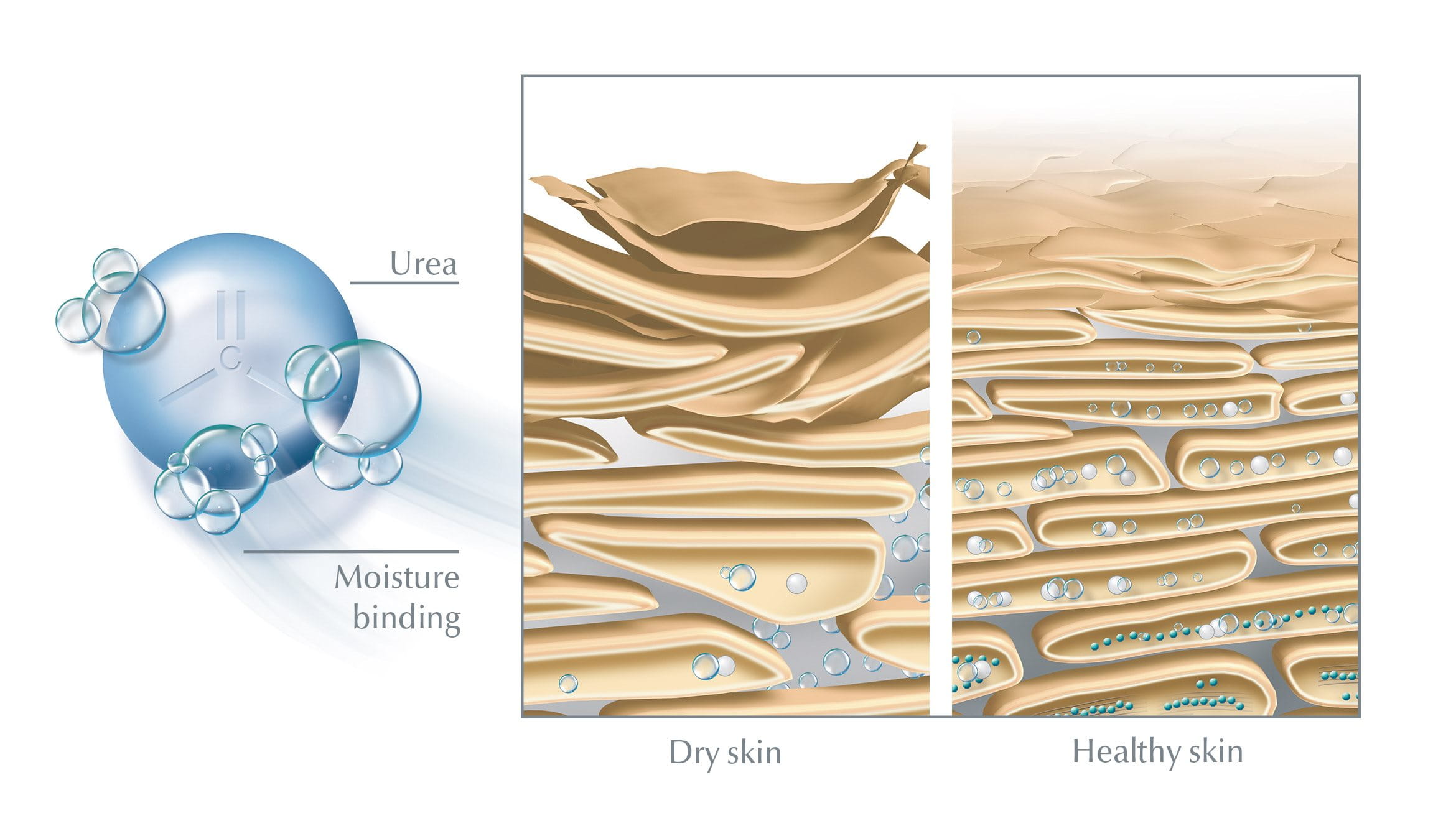 Urea for skin: dry skin v moisturized skin illustration