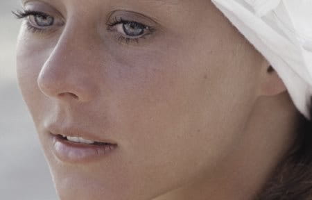 Woman with sunburned cheeks.
