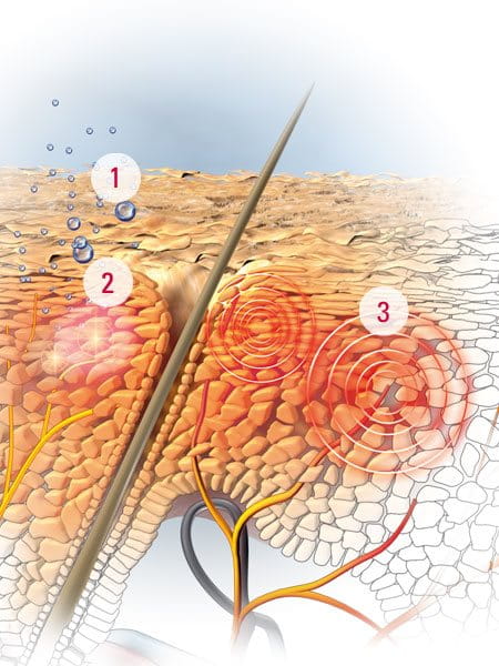 How a dry and itchy scalp develops