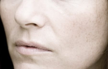 Woman´s face with lines and reddish looking skin.