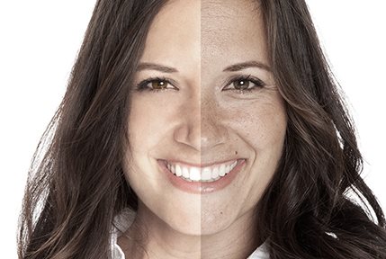 usporedba utjecaja fotostarenja na kožu