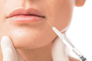 Eingerissene Mundwinkel Behandeln Eucerin