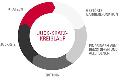Juck-Kratz-Kreislauf