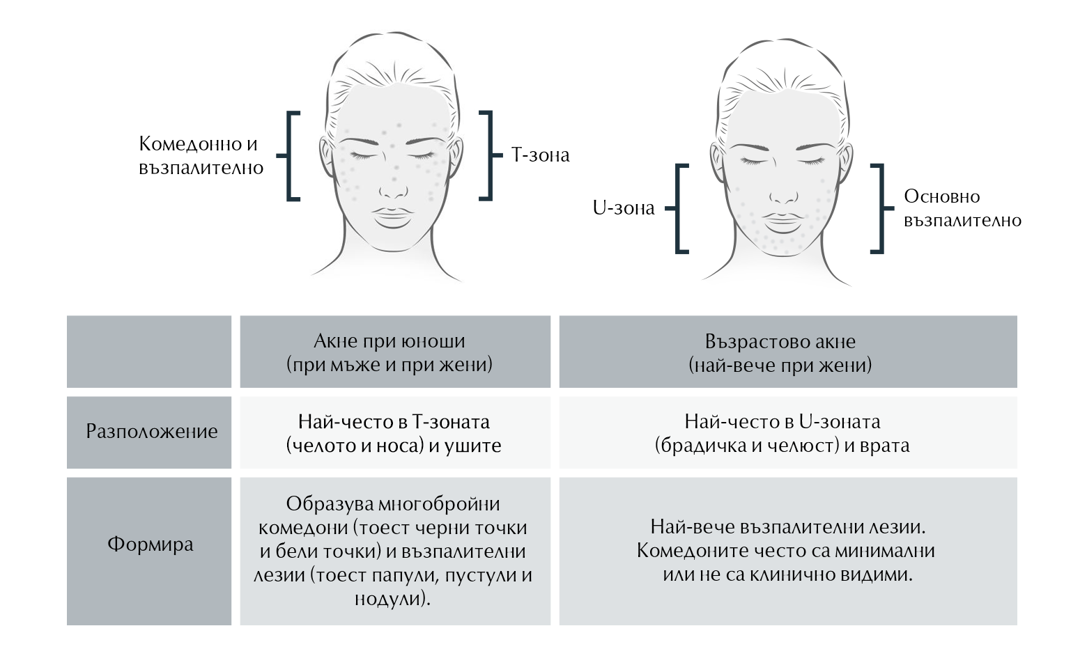 Как акнето се различава според възрастта