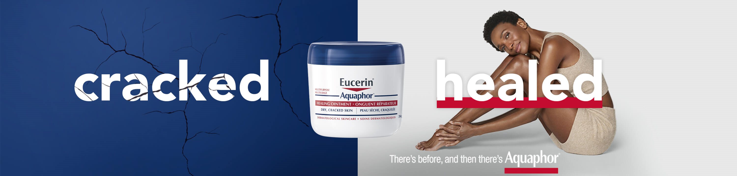 View of a female model with her head resting on her bent knees with a Eucerin Aquaphor Healing Ointment 396g product shown in the background.