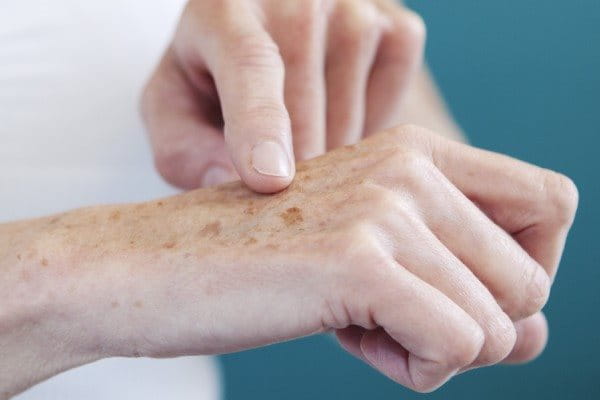 Nahaufnahme einer Hand mit sichtbaren Altersflecken.