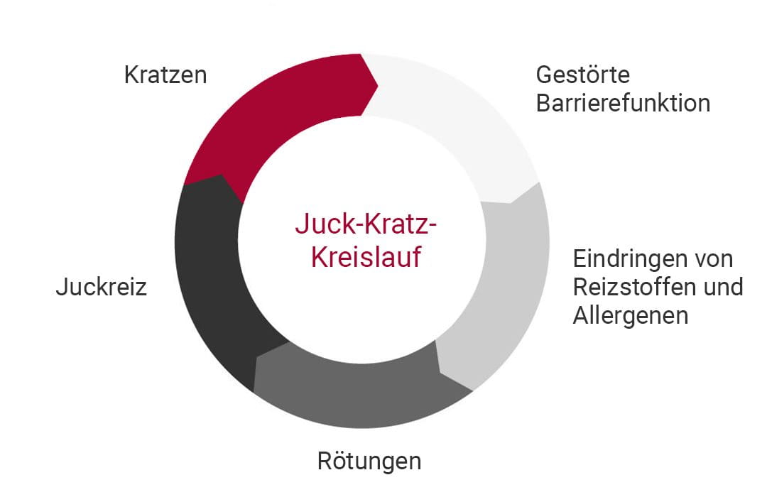 Juck-Kratz-Kreislauf