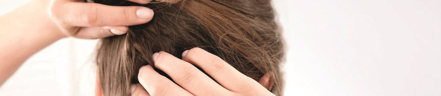 Frau kratzt sich am Hinterkopf die trockene und juckende Kopfhaut