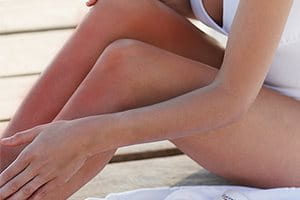 Beine einer Frau mit Mallorca-Akne