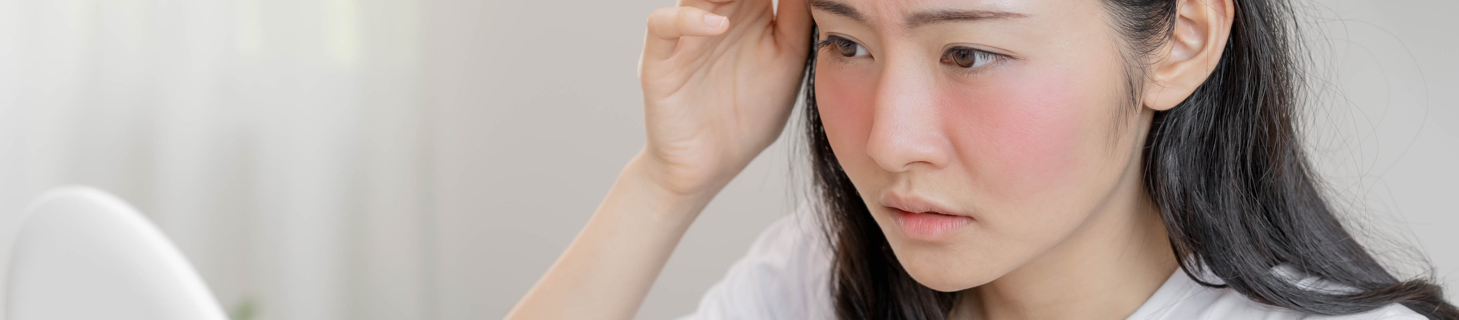 Junge Frau sitzt mit Sonnenbrand im Gesicht vor einem Spiegel.