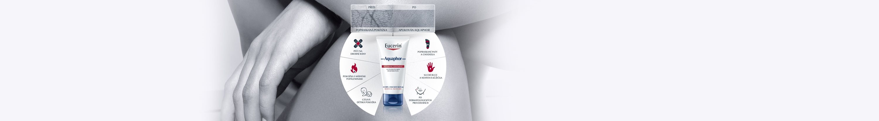 Aquaphor mast na popraskanou pokožku