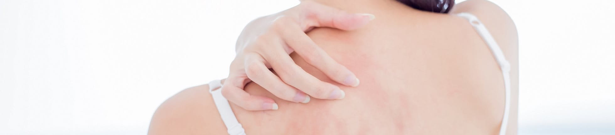 Junge Frau mit Mallorca Akne kratzt sich am Rücken