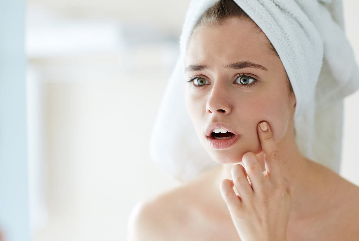 Que faire contre les boutons