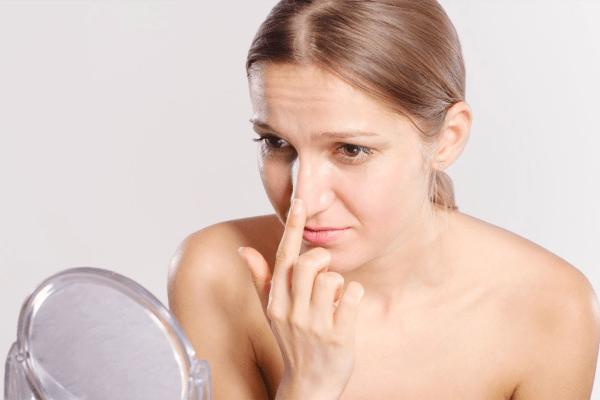 Mitesser treten oft auf der Nase auf