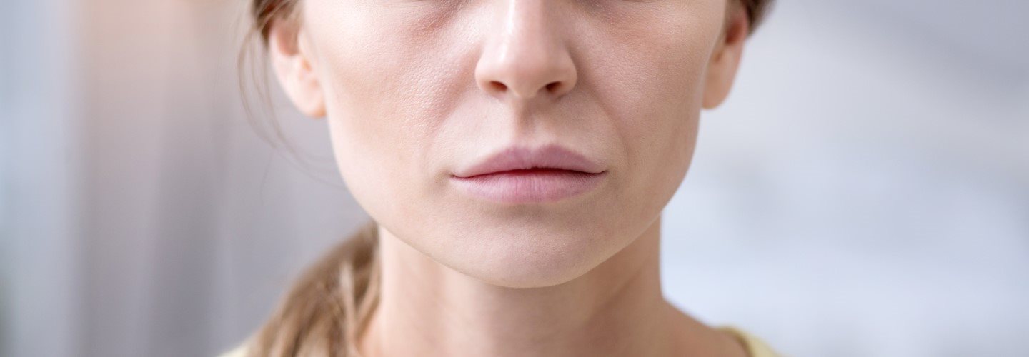 Frau mit blasser, fahler Haut.