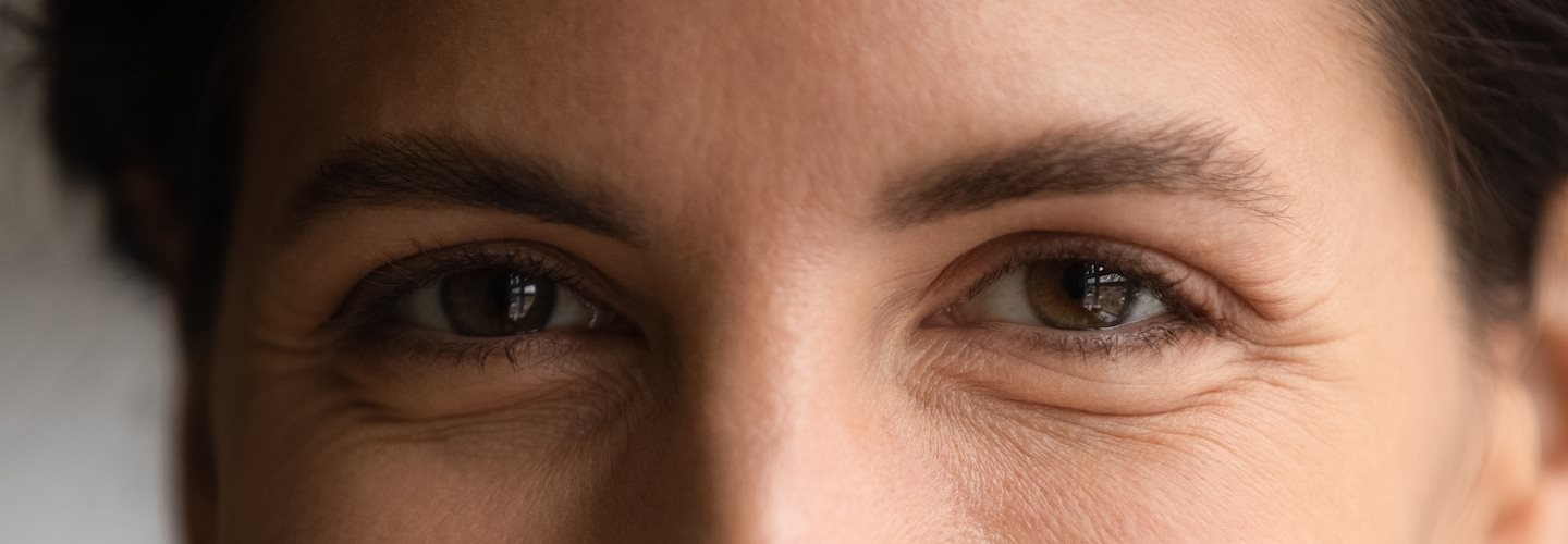 Gesicht einer jungen Frau mit Lachfalten um die Augenpartie