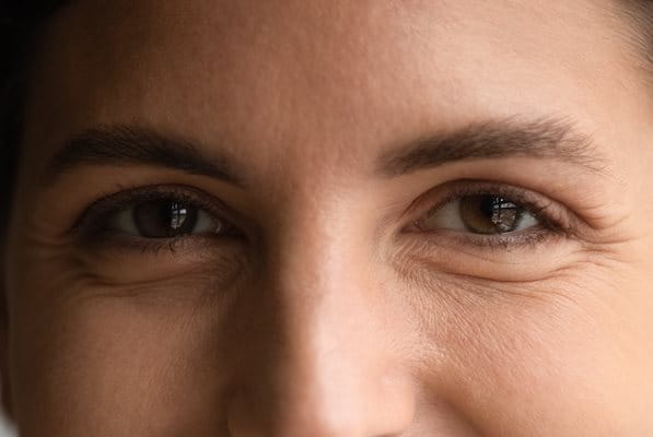 Gesicht einer jungen Frau mit Lachfalten um die Augenpartie