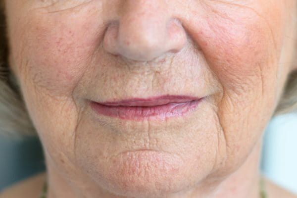 Ausschnitt weibliches Gesicht mit Mundwinkelfalten