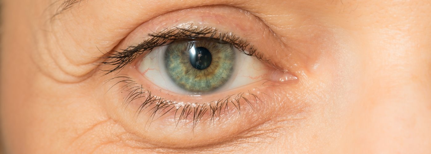 Frau mit Tränensack