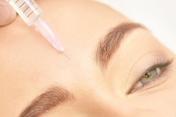 Botoxbehandlung an der Stirn gegen Zornesfalte