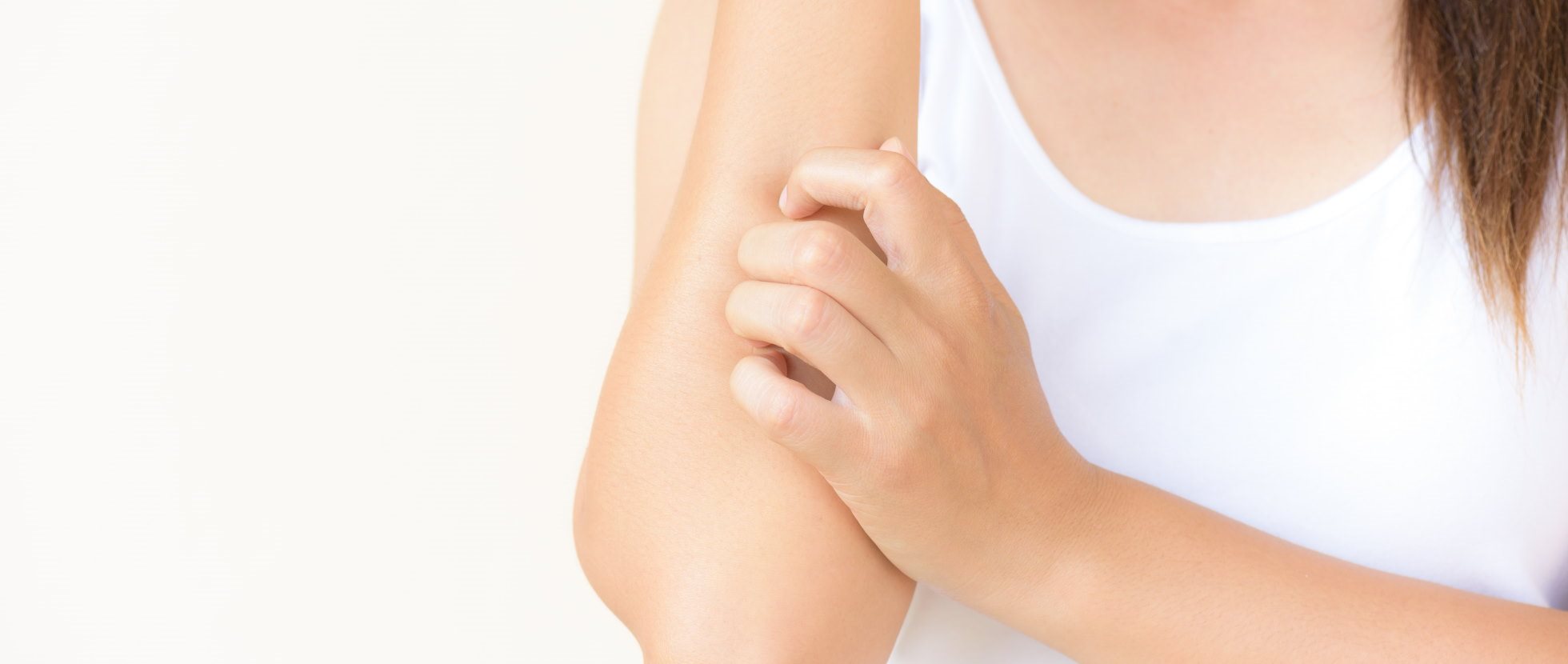 Frau kratzt sich aufgrund von einer allergischen Reaktion der Haut am Arm