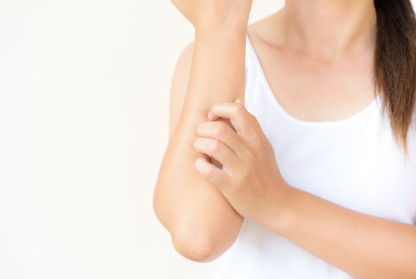 Frau kratzt sich am Arm aufgrund einer allergischen Hautreaktion