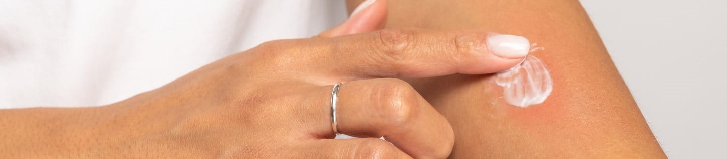 Frau cremt mit dem Finger eine gerötete Stelle am Unterarm ein.