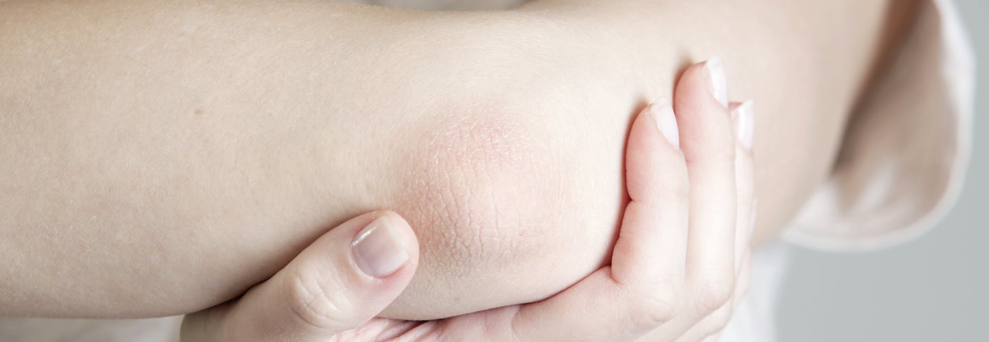 Frau stützt trockenen Ellenbogen auf der Hand ab