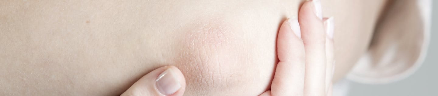 Frau stützt trockenen Ellenbogen auf der Hand ab