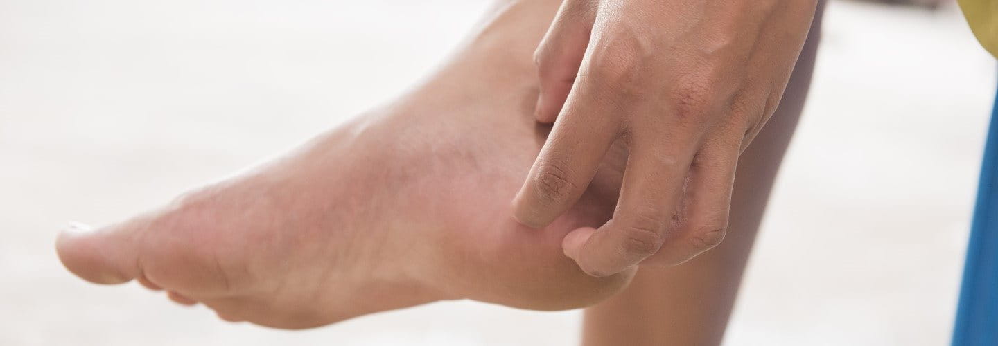 Person kratzt sich am Fuß wegen Juckreiz durch Neurodermitis