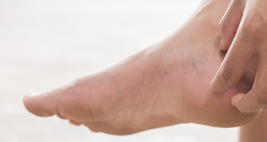 Person kratzt sich am Fuß wegen Juckreiz durch Neurodermitis