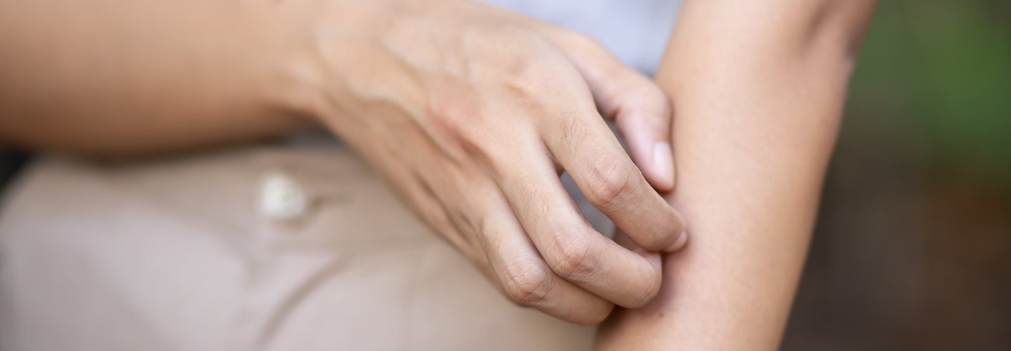 Frau, die sich am Arm kratzt