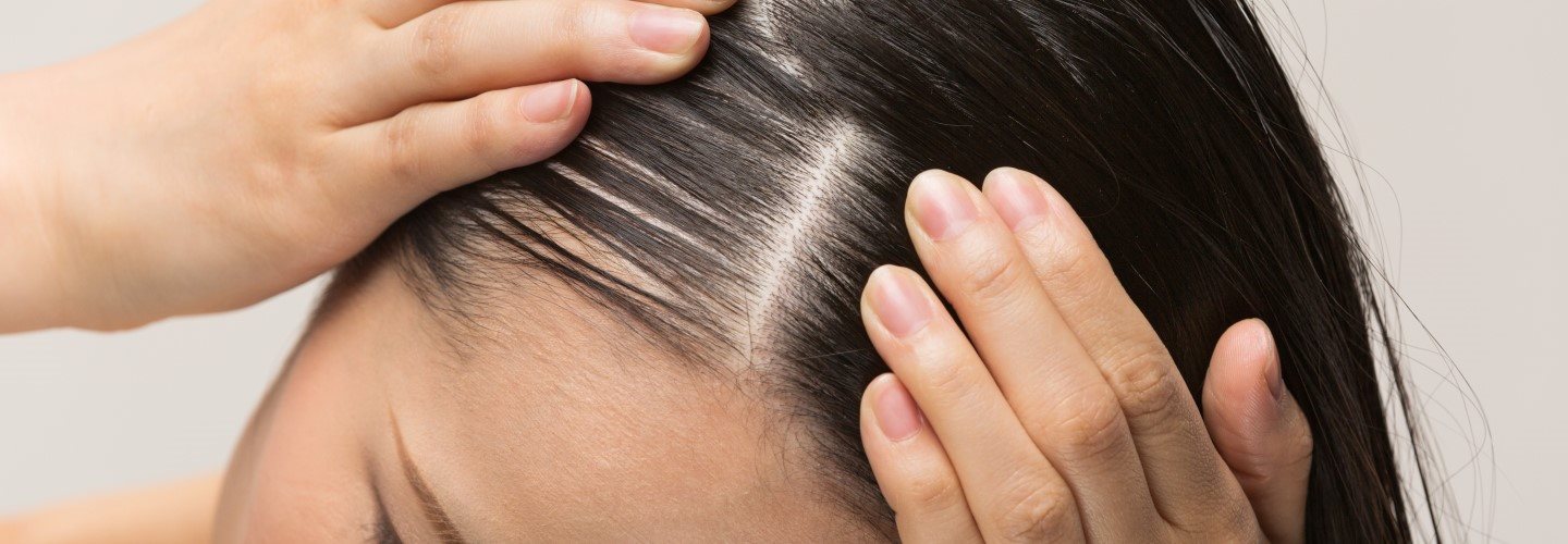 Eine Frau massiert die Kopfhaut