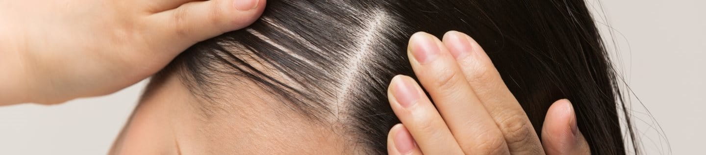 Eine Frau massiert die Kopfhaut