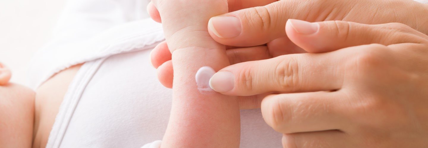 Mutter trägt Salbe auf den neugeborenen Arm auf