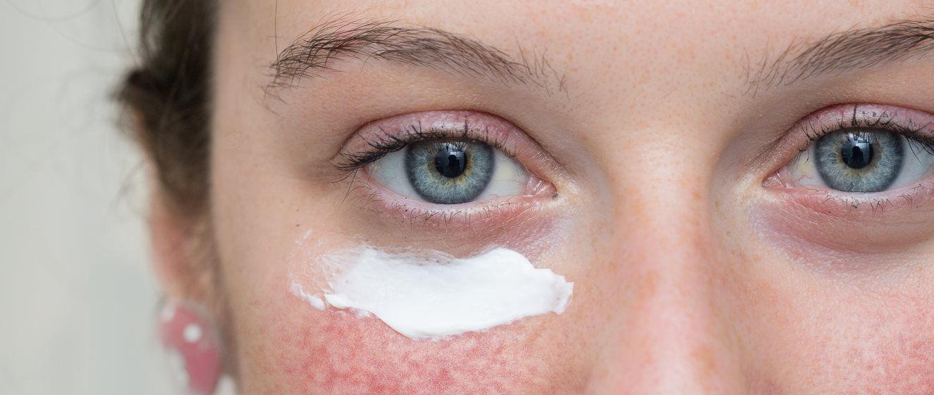 Sonnencreme Rosacea