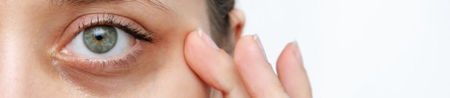 Dunkle Augenringe entstehen oft als Begleiterscheinung von Schlafmangel, Stress oder Erkrankungen. Erfahre hier, was du gegen Augenringe tun kannst.