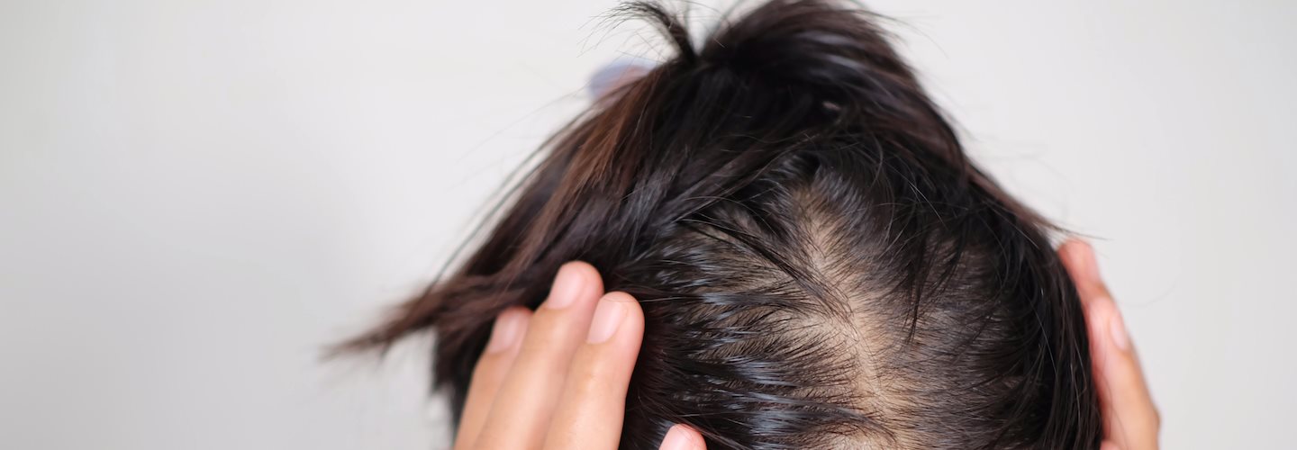 Frau fasst sich mit beiden Händen an den Kopf