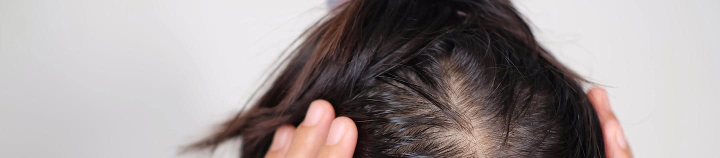 Frau fasst sich mit beiden Händen an den Kopf