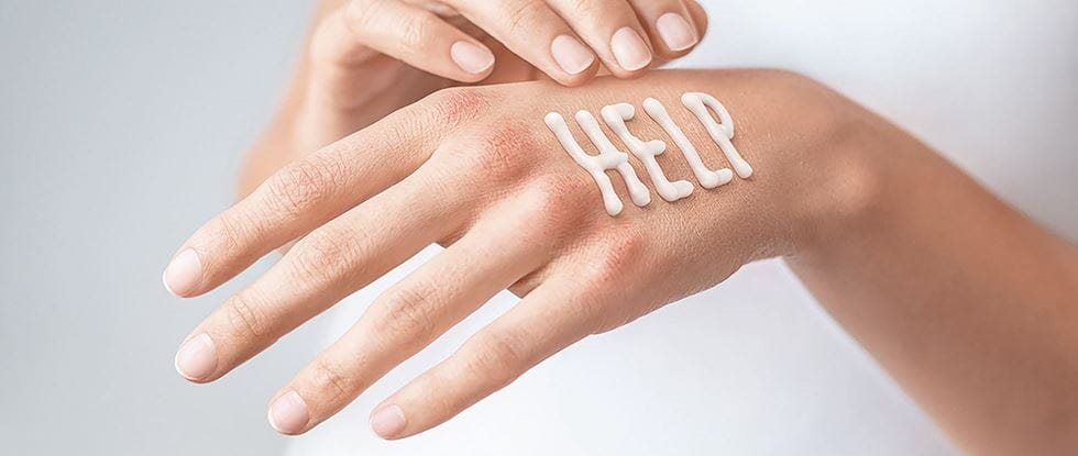 HELP written out on the back of a hand with creme