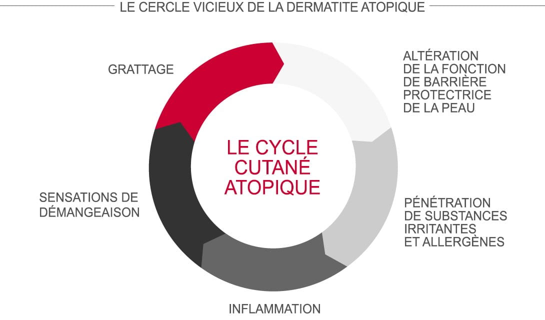 LE CYCLE CUTANÉ ATOPIQUE