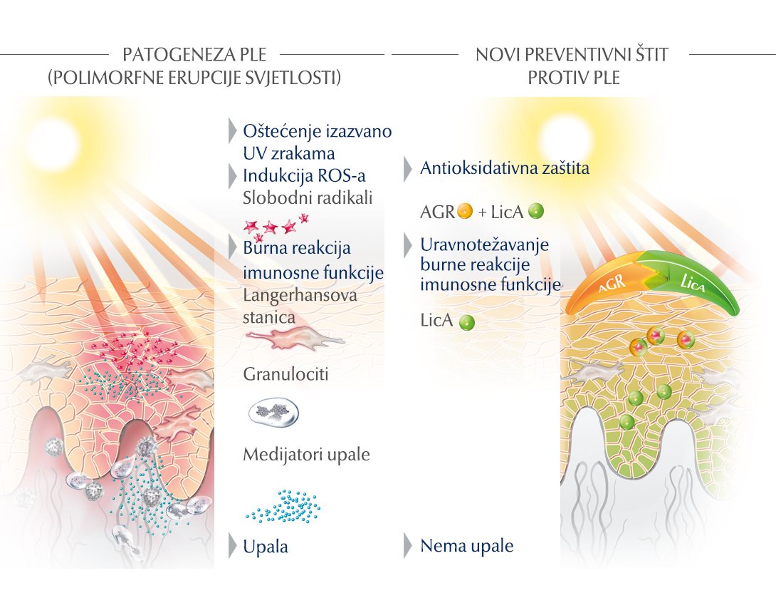 animacija utjecaja UV zraka na kožu i kako se može spriječiti
