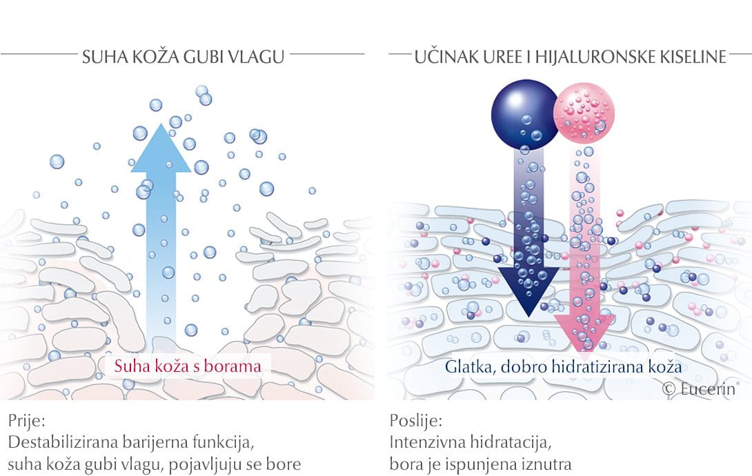 animacija učinka ureje na suhu kožu